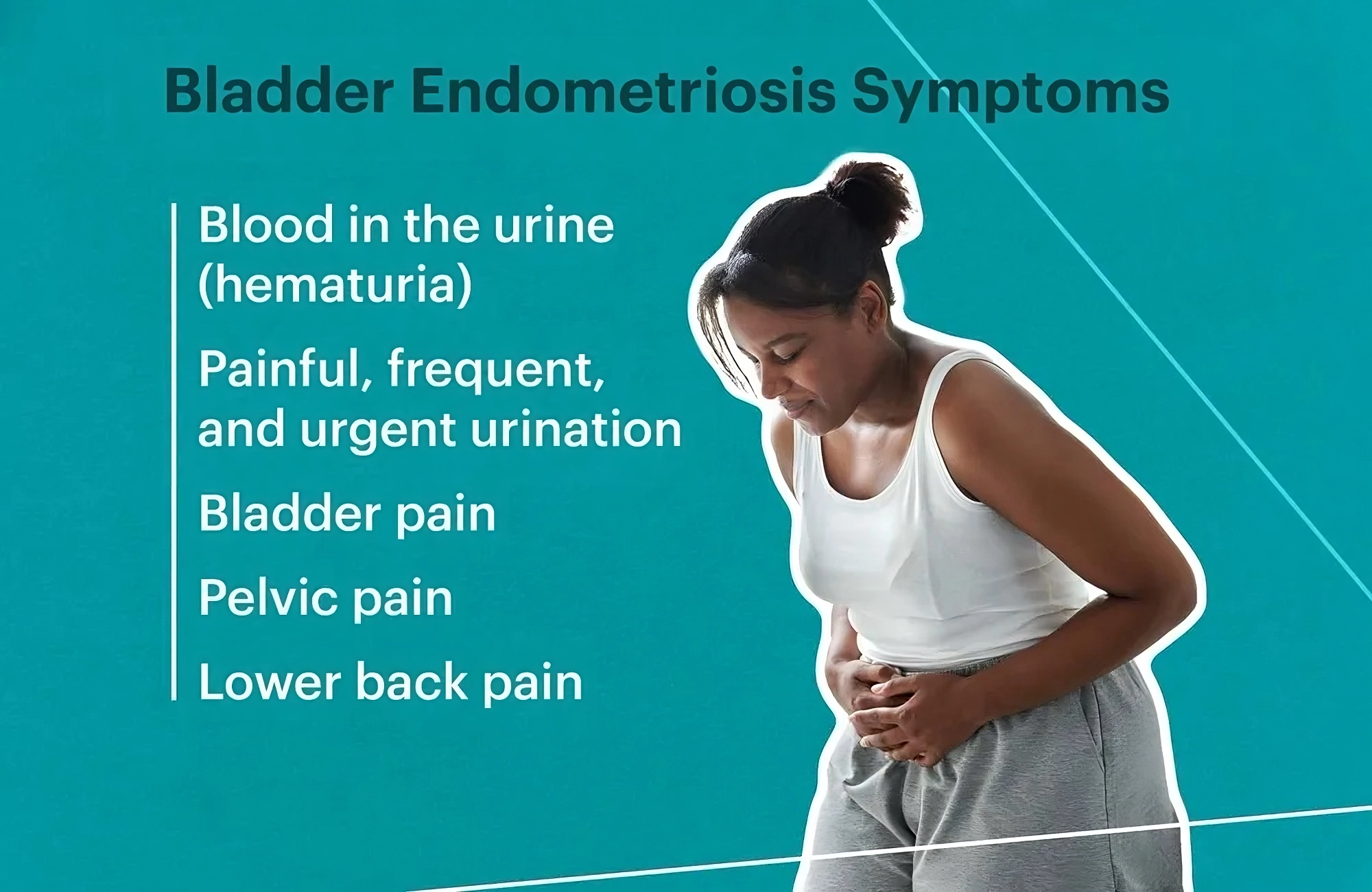 bladder endometriosis: