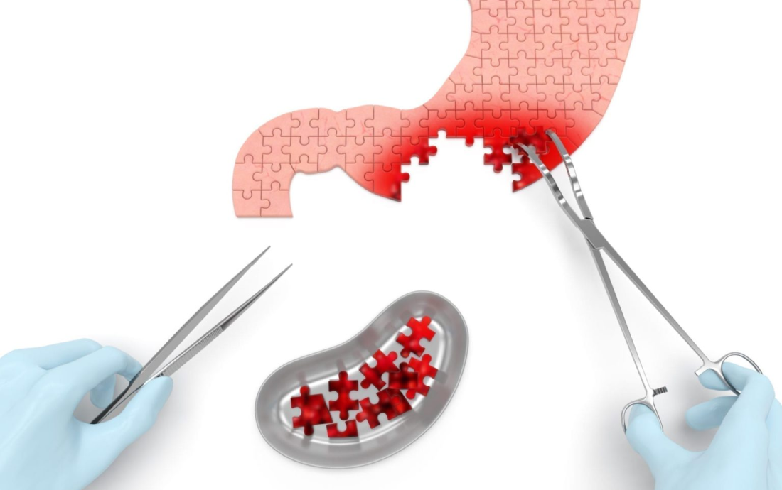 digestive-cancer-care-chennai-and-coimbatore