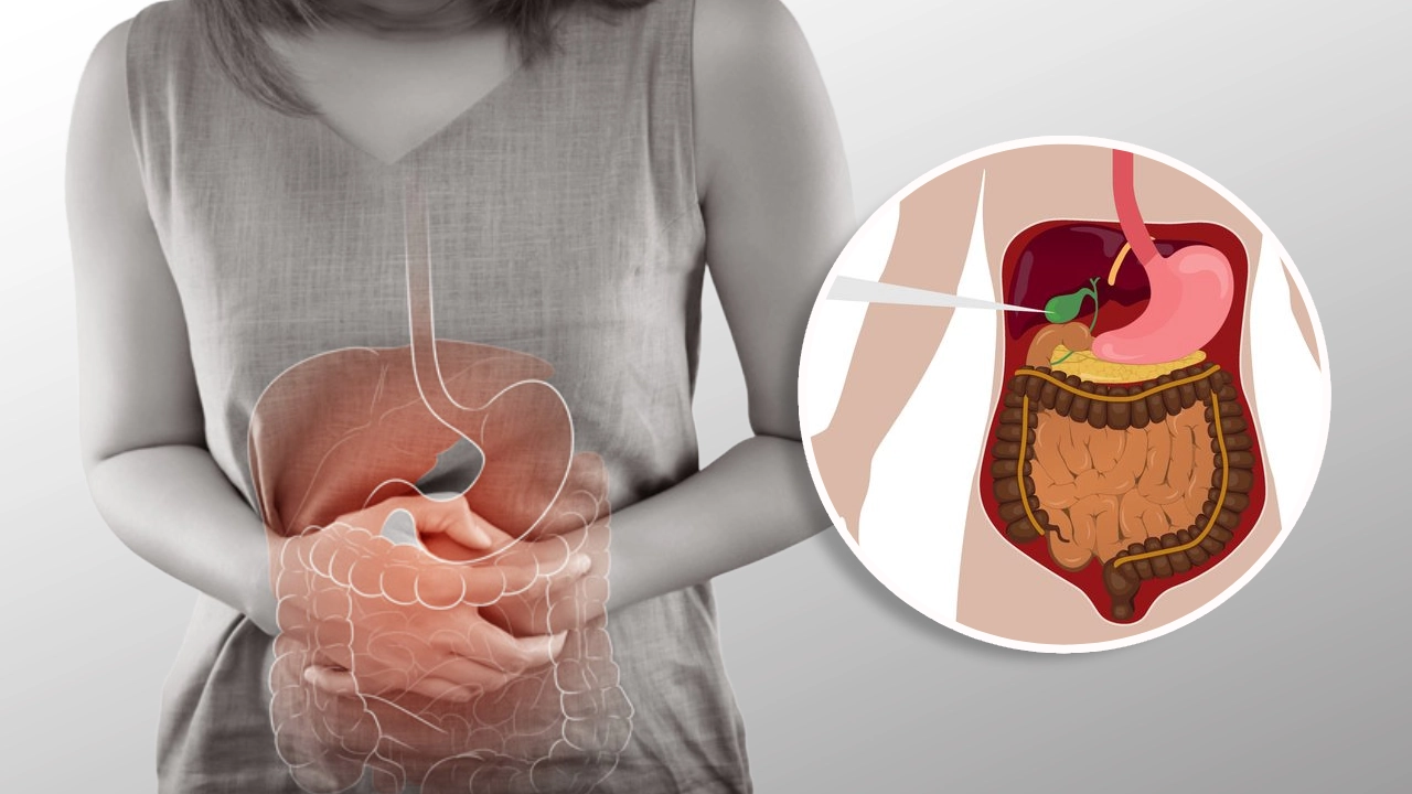 gallbladder-treatment-in-coimbatore-chennai