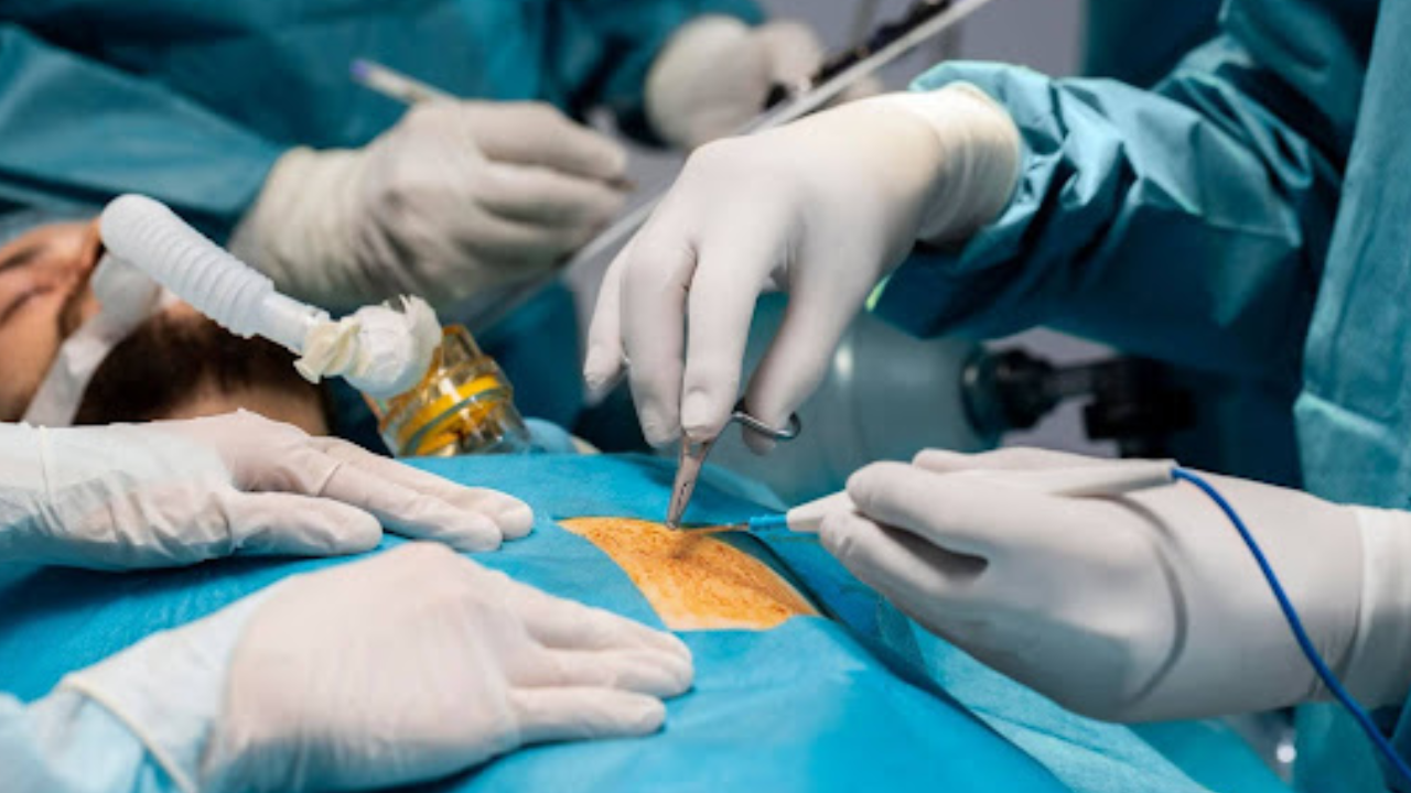 hernia-surgery-in-coimbatore-chennai